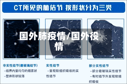 国外肺疫情/国外役情-第1张图片